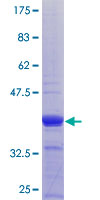 ab164406 on a 12.5% SDS-PAGE stained with Coomassie Blue.