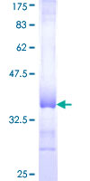 ab158169 on a 12.5% SDS-PAGE stained with Coomassie Blue.