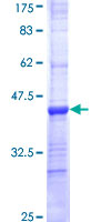 ab158170 on a 12.5% SDS-PAGE stained with Coomassie Blue.