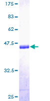 ab163615 on a 12.5% SDS-PAGE stained with Coomassie Blue.
