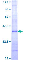 ab164343 on a 12.5% SDS-PAGE stained with Coomassie Blue.