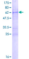 ab164859 on a 12.5% SDS-PAGE stained with Coomassie Blue.