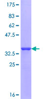 ab164860 on a 12.5% SDS-PAGE stained with Coomassie Blue.