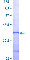 ab158161 on a 12.5% SDS-PAGE stained with Coomassie Blue.