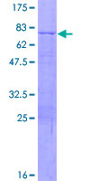 ab158163 on a 12.5% SDS-PAGE stained with Coomassie Blue.