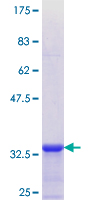 ab158164 on a 12.5% SDS-PAGE stained with Coomassie Blue.