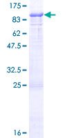 ab164315 on a 12.5% SDS-PAGE stained with Coomassie Blue.