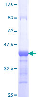 ab164316 on a 12.5% SDS-PAGE stained with Coomassie Blue.