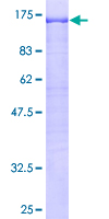 ab158155 on a 12.5% SDS-PAGE stained with Coomassie Blue.