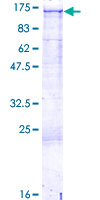 ab158156 on a 12.5% SDS-PAGE stained with Coomassie Blue.