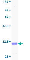 ab158158 on a 12.5% SDS-PAGE stained with Coomassie Blue.