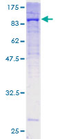 ab158159 on a 12.5% SDS-PAGE stained with Coomassie Blue.