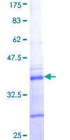 ab158160 on a 12.5% SDS-PAGE stained with Coomassie Blue.