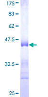 ab162340 on a 12.5% SDS-PAGE stained with Coomassie Blue.