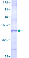 ab158168 on a 12.5% SDS-PAGE stained with Coomassie Blue.