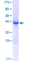 ab162909 on a 12.5% SDS-PAGE stained with Coomassie Blue.