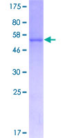 ab165148 on a 12.5% SDS-PAGE stained with Coomassie Blue.