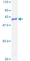 ab165284 on a 12.5% SDS-PAGE stained with Coomassie Blue.