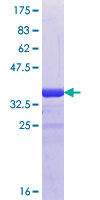 ab153446 on a 12.5% SDS-PAGE stained with Coomassie Blue.