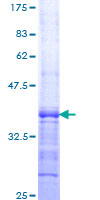 ab165027 on a 12.5% SDS-PAGE stained with Coomassie Blue.