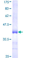 ab153483 on a 12.5% SDS-PAGE stained with Coomassie Blue.
