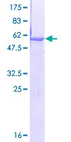 ab161409 on a 12.5% SDS-PAGE stained with Coomassie Blue.