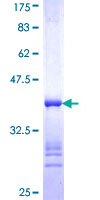 ab161410 on a 12.5% SDS-PAGE stained with Coomassie Blue.