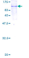 ab162042 on a 12.5% SDS-PAGE stained with Coomassie Blue.