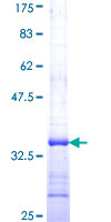 ab162043 on a 12.5% SDS-PAGE stained with Coomassie Blue.