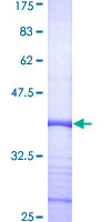 ab161225 on a 12.5% SDS-PAGE stained with Coomassie Blue.