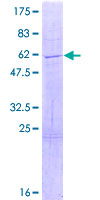 ab162359 on a 12.5% SDS-PAGE stained with Coomassie Blue.