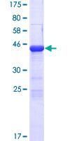 ab162463 on a 12.5% SDS-PAGE stained with Coomassie Blue.