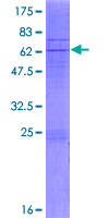 ab162116 on a 12.5% SDS-PAGE stained with Coomassie Blue.