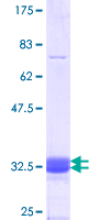 ab162117 on a 12.5% SDS-PAGE stained with Coomassie Blue.