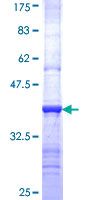 ab162669 on a 12.5% SDS-PAGE stained with Coomassie Blue.