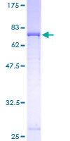 ab162386 on a 12.5% SDS-PAGE stained with Coomassie Blue.
