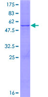 ab160891 on a 12.5% SDS-PAGE stained with Coomassie Blue.