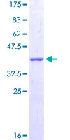 ab161709 on a 12.5% SDS-PAGE stained with Coomassie Blue.