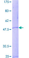 ab158198 on a 12.5% SDS-PAGE stained with Coomassie Blue.