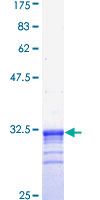 ab158199 on a 12.5% SDS-PAGE stained with Coomassie Blue.