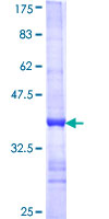 ab158173 on a 12.5% SDS-PAGE stained with Coomassie Blue.