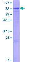 ab159277 on a 12.5% SDS-PAGE stained with Coomassie Blue.