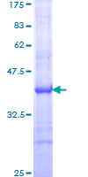 ab159278 on a 12.5% SDS-PAGE stained with Coomassie Blue.