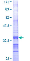 ab158184 on a 12.5% SDS-PAGE stained with Coomassie Blue.