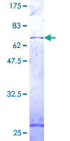 ab158186 on a 12.5% SDS-PAGE stained with Coomassie Blue.