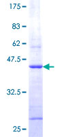 ab158174 on a 12.5% SDS-PAGE stained with Coomassie Blue.