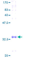 ab158178 on a 12.5% SDS-PAGE stained with Coomassie Blue.