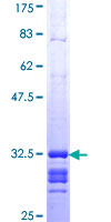 ab158179 on a 12.5% SDS-PAGE stained with Coomassie Blue.