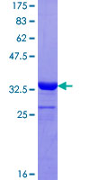 ab160367 on a 12.5% SDS-PAGE stained with Coomassie Blue.