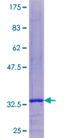 ab158182 on a 12.5% SDS-PAGE stained with Coomassie Blue.